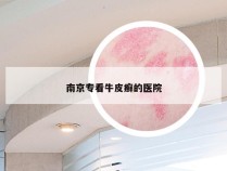 南京专看牛皮癣的医院