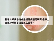 指甲针眼状小凹点是银屑病还是缺钙 指甲上出现针眼样小坑是怎么回事?