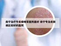 南宁治疗牛皮癣哪家医院最好 南宁专治皮肤病比较好的医院