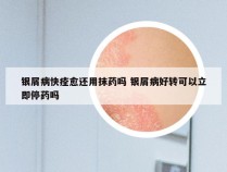 银屑病快痊愈还用抹药吗 银屑病好转可以立即停药吗
