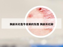 胸前长红色牛皮癣的东西 胸前长红藓