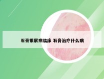 石膏银屑病临床 石膏治疗什么病