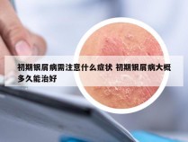 初期银屑病需注意什么症状 初期银屑病大概多久能治好