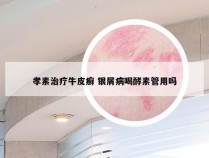 孝素治疗牛皮癣 银屑病喝酵素管用吗