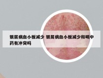 银屑病血小板减少 银屑病血小板减少和喝中药有冲突吗