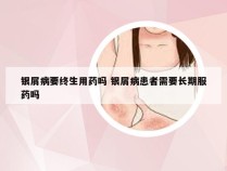 银屑病要终生用药吗 银屑病患者需要长期服药吗