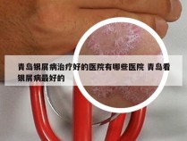 青岛银屑病治疗好的医院有哪些医院 青岛看银屑病最好的