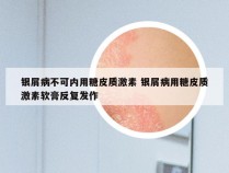 银屑病不可内用糖皮质激素 银屑病用糖皮质激素软膏反复发作