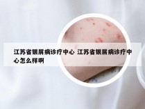 江苏省银屑病诊疗中心 江苏省银屑病诊疗中心怎么样啊
