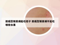 脓疱型银屑病能吃桔子 脓疱型银屑病不能吃哪些水果