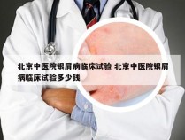 北京中医院银屑病临床试验 北京中医院银屑病临床试验多少钱