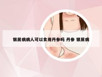 银屑病病人可以食用丹参吗 丹参 银屑病