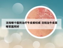 沈阳哪个医院治疗牛皮癣权威 沈阳治牛皮屑哪家医院好