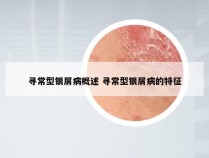 寻常型银屑病概述 寻常型银屑病的特征