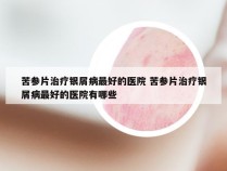苦参片治疗银屑病最好的医院 苦参片治疗银屑病最好的医院有哪些