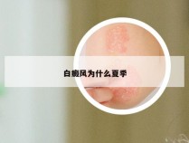 白癜风为什么夏季