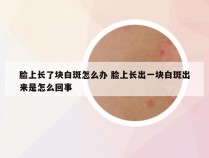 脸上长了块白斑怎么办 脸上长出一块白斑出来是怎么回事