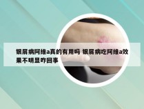银屑病阿维a真的有用吗 银屑病吃阿维a效果不明显咋回事