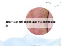 草味十三方治疗银屑病 草方十三味原浆洗发水