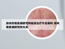 郑州市银屑病研究所输液治疗牛皮癣吗 郑州银屑病研究所大夫
