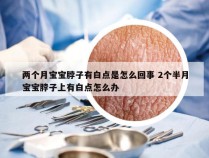 两个月宝宝脖子有白点是怎么回事 2个半月宝宝脖子上有白点怎么办