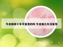 牛皮癣有十年不复发的吗 牛皮癣几年没复发