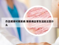 作息规律对银屑病 银屑病日常生活应注意什么