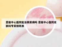 恩施中心医院能治银屑病吗 恩施中心医院皮肤科专家排班表