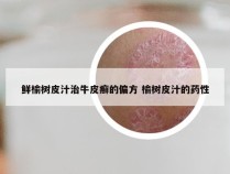 鲜榆树皮汁治牛皮癣的偏方 榆树皮汁的药性