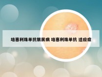 培塞利珠单抗银屑病 培塞利珠单抗 适应症