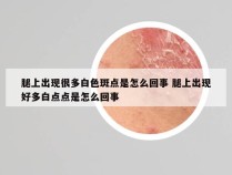 腿上出现很多白色斑点是怎么回事 腿上出现好多白点点是怎么回事