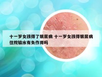 十一岁女孩得了银屑病 十一岁女孩得银屑病住院输水有负作用吗