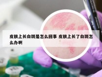 皮肤上长白斑是怎么回事 皮肤上长了白斑怎么办啊