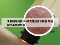 生物制剂药物17a单克隆抗多少钱啊 生物制剂单克隆抗体