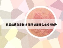银屑病胰岛素抵抗 银屑病用什么免疫抑制剂