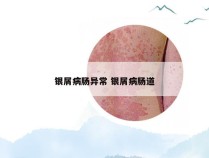 银屑病肠异常 银屑病肠道