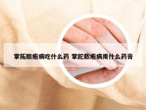 掌拓脓疱病吃什么药 掌跎脓疱病用什么药膏