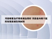 河南哪里治疗银屑病治得好 河南省内哪个医院有银屑病生物制剂