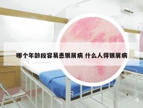 哪个年龄段容易患银屑病 什么人得银屑病