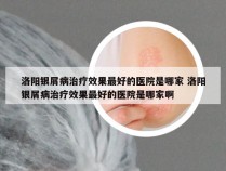 洛阳银屑病治疗效果最好的医院是哪家 洛阳银屑病治疗效果最好的医院是哪家啊
