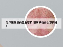 治疗银屑病的昆虫草药 银屑病吃什么草药好?