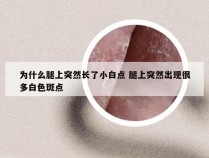 为什么腿上突然长了小白点 腿上突然出现很多白色斑点