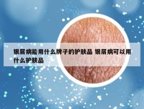 银屑病能用什么牌子的护肤品 银屑病可以用什么护肤品