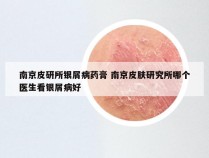 南京皮研所银屑病药膏 南京皮肤研究所哪个医生看银屑病好