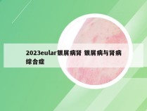 2023eular银屑病肾 银屑病与肾病综合症
