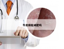 牛皮癣能减肥吗