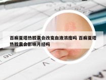 百癣夏塔热胶囊会改变血液浓度吗 百癣夏塔热胶囊会影响月经吗