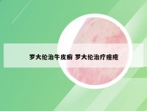 罗大伦治牛皮癣 罗大伦治疗痤疮