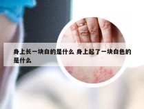 身上长一块白的是什么 身上起了一块白色的是什么