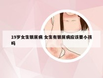19岁女生银屑病 女生有银屑病应该要小孩吗